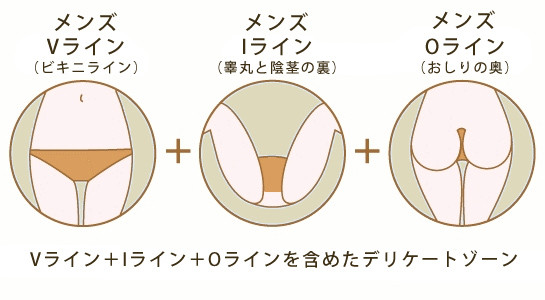 ブラジリアンワックスでVIO脱毛を続けると薄くなるって本当なの？