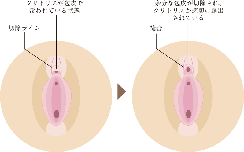 帯広中央クリニック｜婦人科形成専門クリニック｜女性器について