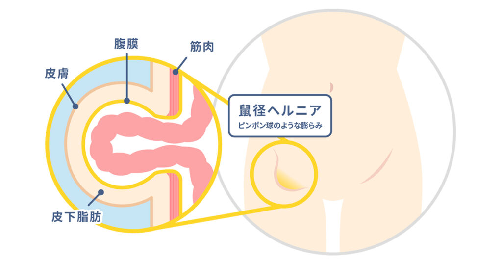 鼠径部マッサージ】京都府のメンズエステ一覧｜メンズリラク