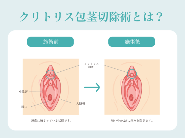 膣の「上つき・下つき」の違いと判断方法。「上つき・下つき」それぞれの女性が感じるオススメの体位 | 日刊SODオンライン