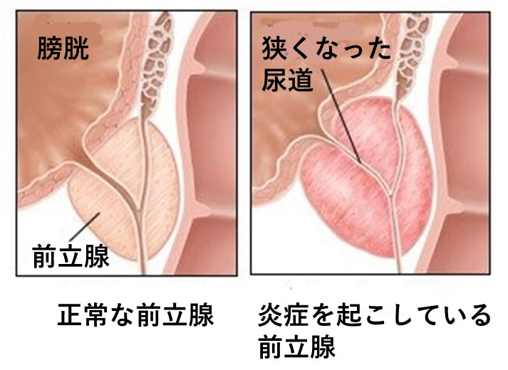 アナルオナニーをするなら前立腺・膀胱・精嚢の位置をイメージせよ | アネドラ