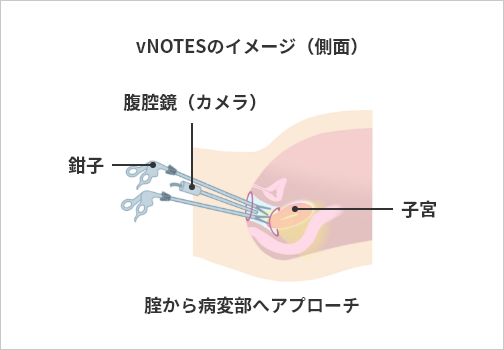 今さら聞けない女性器の構造について。上付き下付きを知る方法