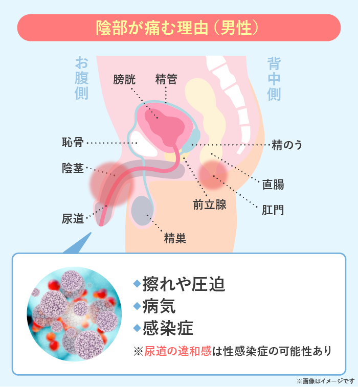 コンドームのサイズの測り方！ずれる対処法【医師監修】 - 夜の保健室