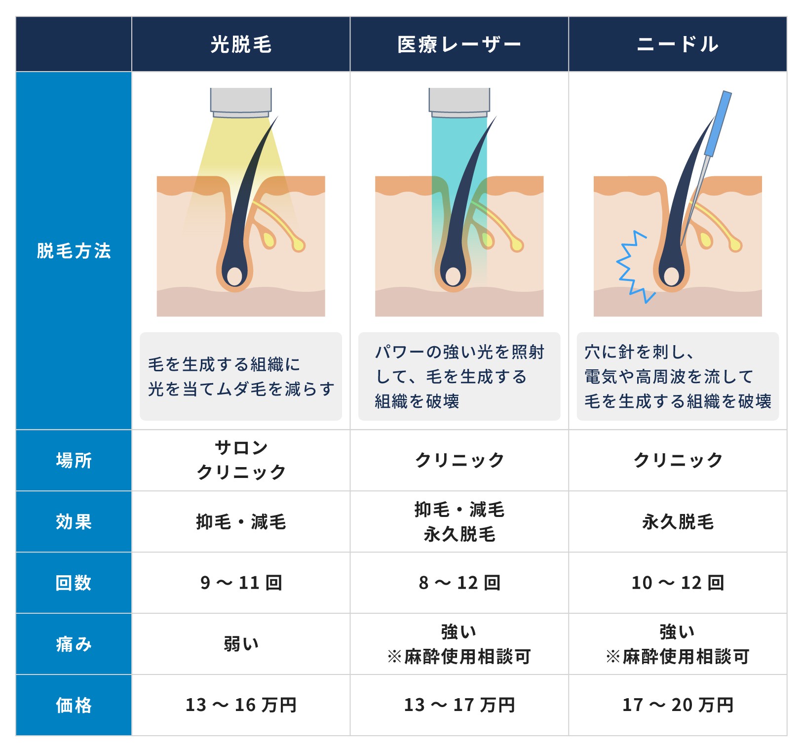 自由が丘目黒店】メンズ脱毛・ヒゲ脱毛専門店RINX（リンクス）｜全国88店舗