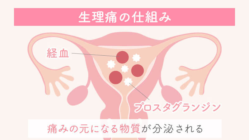 性交時頭痛（セックスやオナニーの時に頭が痛くなる）の症状、原因、対処法 - YouTube