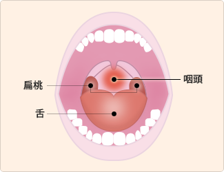 性病は予防することができる！安全に性行為を行うために大切な7つの方法 - ココロ薬局コラム