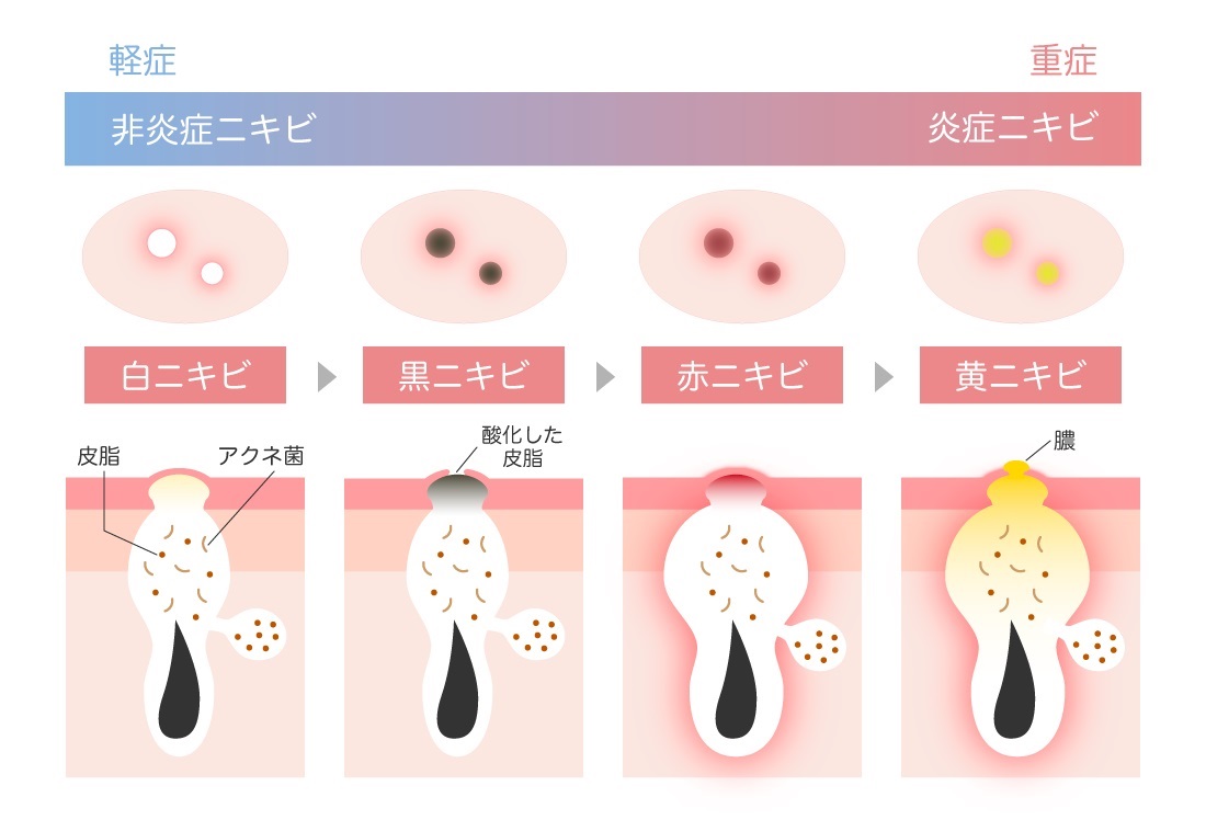 性交痛」膣と肛門の間(会陰部)が痛い！原因と治療法を紹介。 – 港区、品川区の産婦人科で妊婦健診・産後ケア・避妊相談なら│海老根ウィメンズクリニック