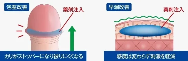 陰茎の大きさの基準は？ 大きく見せる方法も紹介