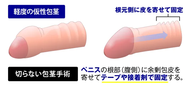 教えて！男の子の性器の洗い方・皮の剥き方やケアの方法（赤ちゃん～幼児頃） | 家庭ではじめる性教育サイト命育