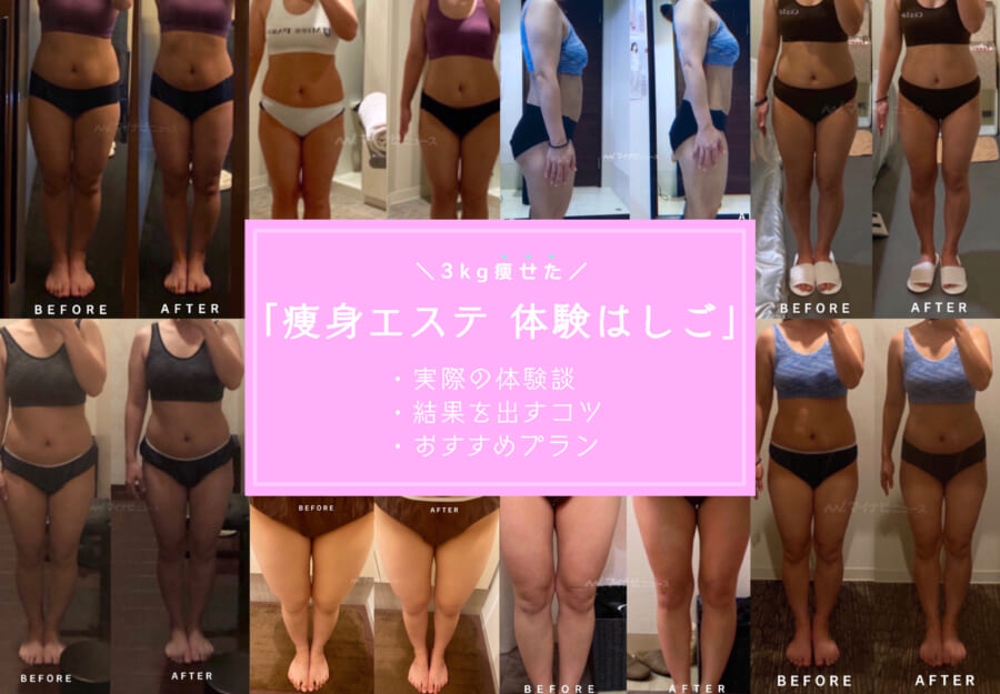 痩身エステ18万円の成果はいかに？アラフォー女子のダイエット Before/After -