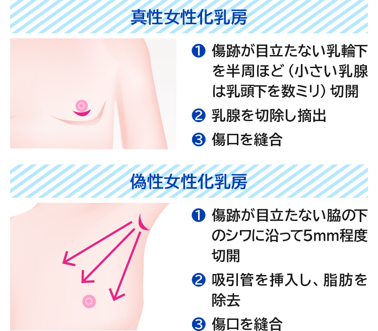 チクニーの気持ちいいやり方とコツ｜感度別での乳首開発と合わせて解説｜駅ちか！風俗雑記帳