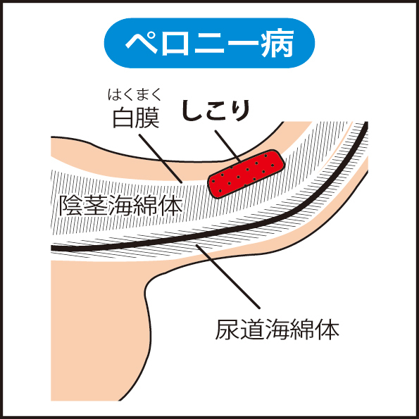 ヤリチンが解説】本当は気持ち良いペニスの反り！角度次第でGスポットに当たりまくり！ | Trip-Partner[トリップパートナー]