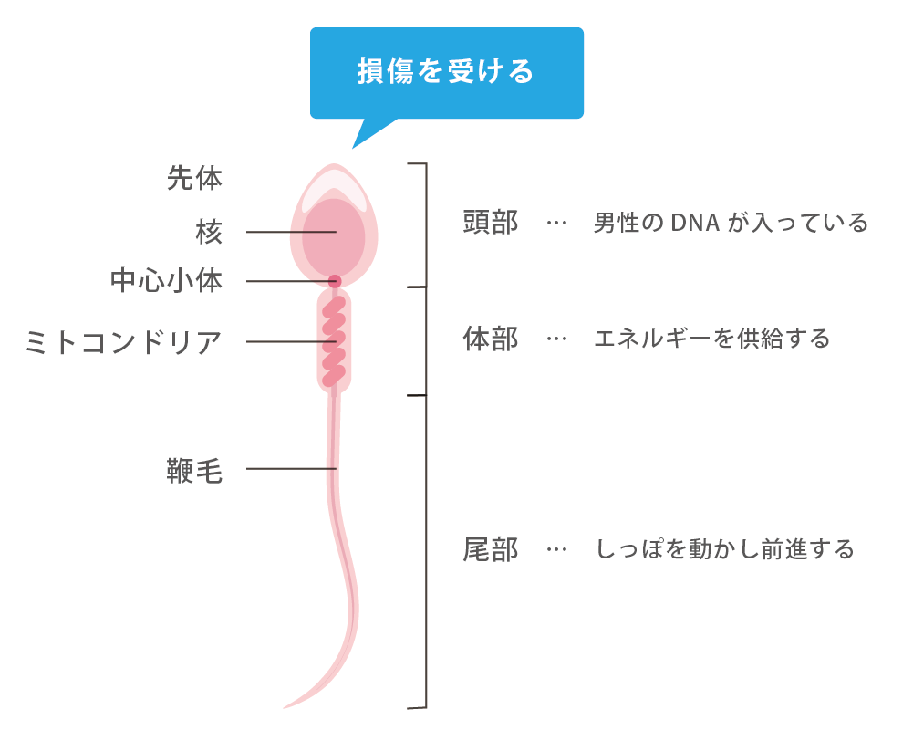 男性不妊の特徴、見た目や自覚症状で分かる？なりやすい人の特徴とは | 男性不妊治療は銀座リプロ外科