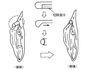 クリトリスの場所はどこ？構造・役割と快感を感じるためのいじり方 | Ray(レイ)