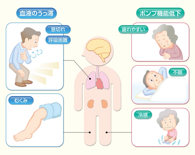 若い女性とバセドウ病｜女性と心臓・血管の病気｜心臓・血管の話 - みやけ内科・循環器科