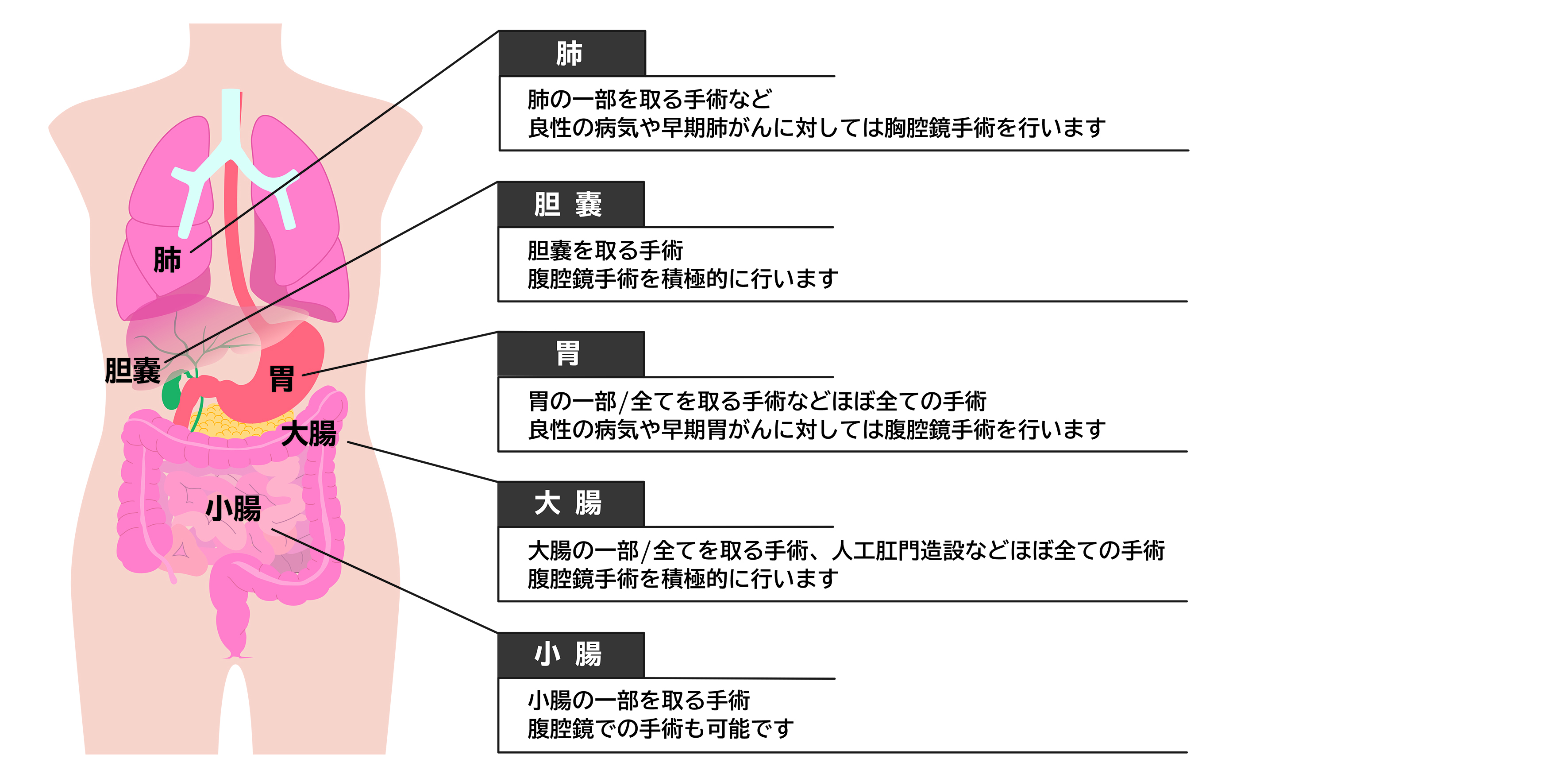 鼠径ヘルニア｜外科医｜太田勝也 | 🩺