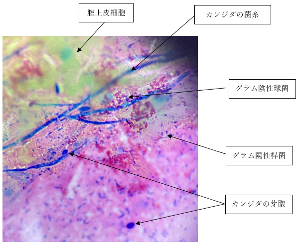 ベッドやマットレスが臭い原因を解説！家庭でできる対策法やおすすめの商品も紹介 – RASIK（ラシク）家具・インテリア専門店