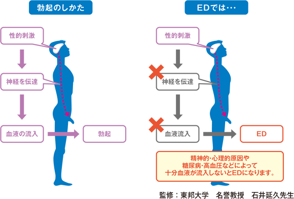 EDのことを知る | EDの原因は？ |