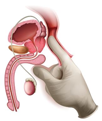 前立腺オナニーとは？失敗しないやり方と感想21人分 | STERON