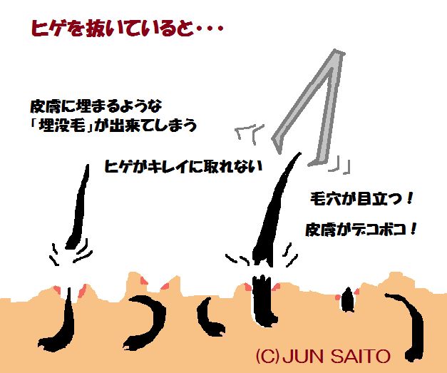 毛抜きでヒゲを抜くと生えなくなる？｜髭の自己処理方法の比較とヒゲをなくす方法 | エピステ