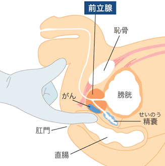 前立腺バイブ 究極対決｜アダルトグッズ通販のNLS