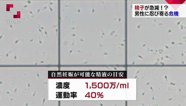 精液、精子に血が混じる（血精液症） | 埼玉県大宮駅と東京都上野駅の泌尿器科