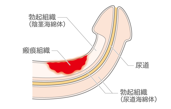 はじめてのセックス、その前に。わたしたちのHow to SEX【医師監修】 | セイシル