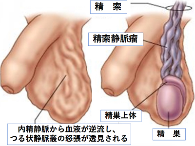 風邪の時にオナニーしてOK？免疫力に影響？【医師監修】 - 夜の保健室