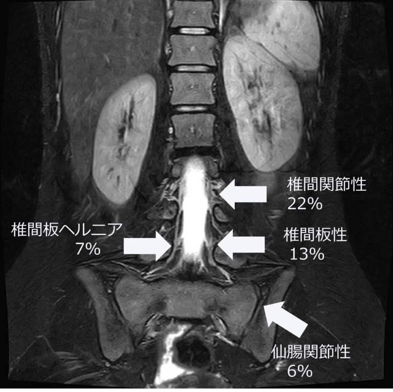 タイミー】スキマバイトは腰痛持ちでも出来る仕事・求人・案件はあるのか解説【メルカリハロ・シェアフル】【ＬＩＮＥスキマニ・ショットワークス】 - ロボナビ