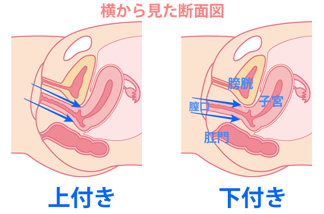 婦人科形成・女性器の整形 - 膣・小陰唇縮小｜静岡美容外科橋本クリニック