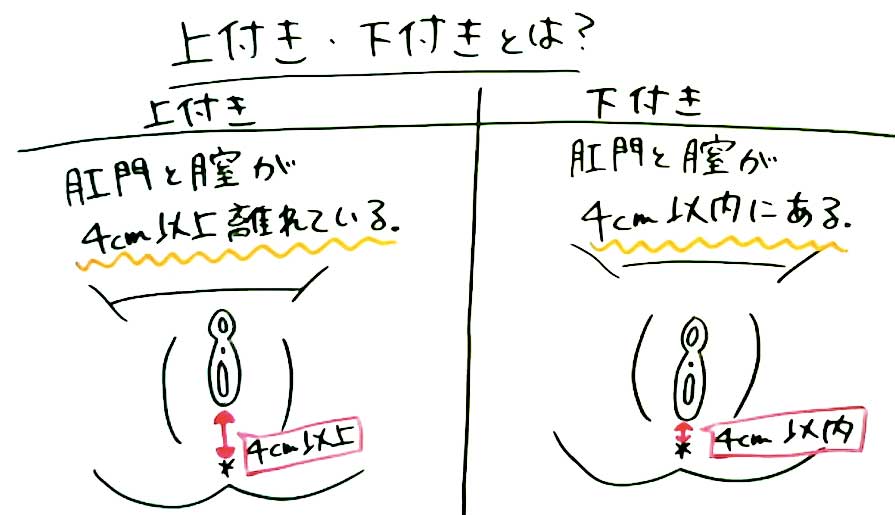 膣ケア・膣トレはデリケートゾーンの不調に効果的！初心者もできる基本方法｜wakanote