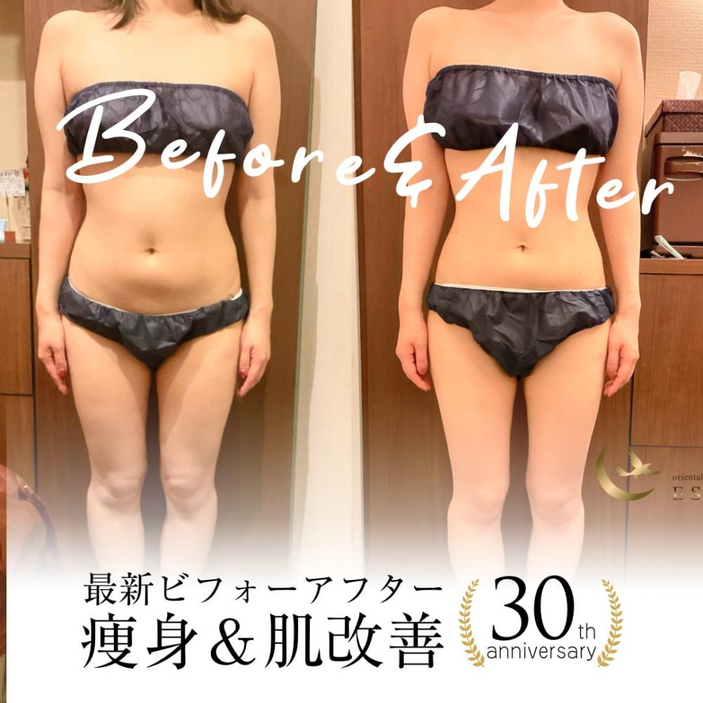 ダイエットをするならミスパリ ダイエットセンター