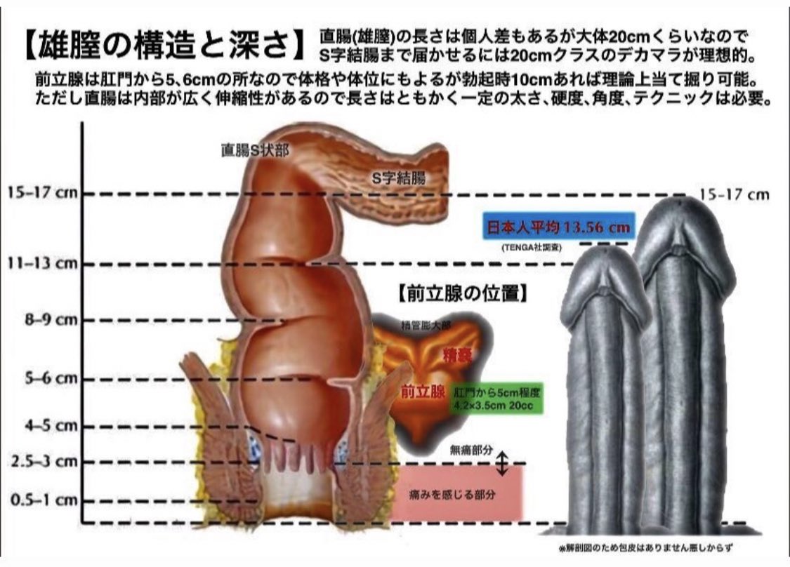 フック　ひっかけフック　栓抜き付き　 S字 フック ステンレス ランタンフック