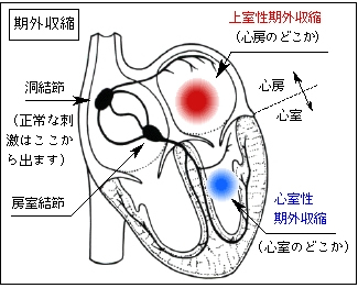 強迫性障害とは｜原因と治療方法、日常での対処法などを解説します【医師監修】