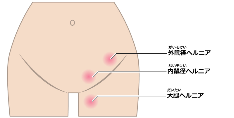 皮膚科｜別府市の鳴海クリニック