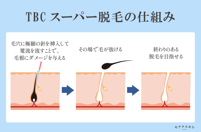 エステティックTBC 名古屋駅前本店の料金プラン・アクセス |