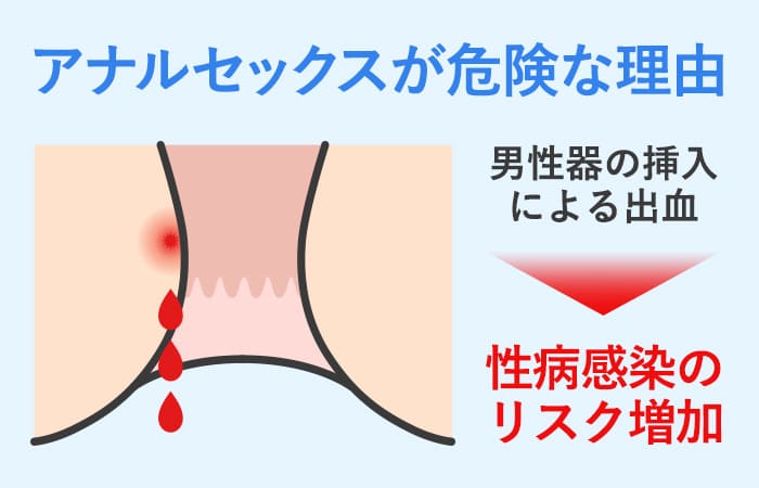 初心者向けアナルセックスのやり方教えます