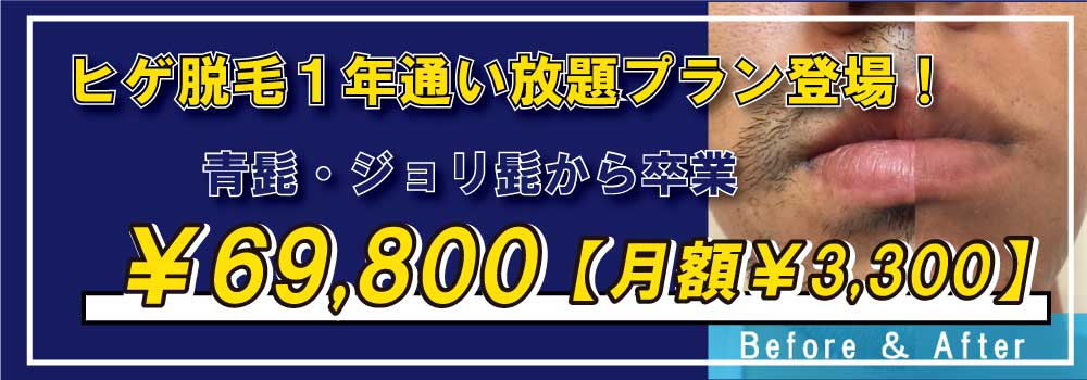 ゴリラクリニック大阪心斎橋院のご案内 | 髭（ヒゲ）のゴリラ脱毛