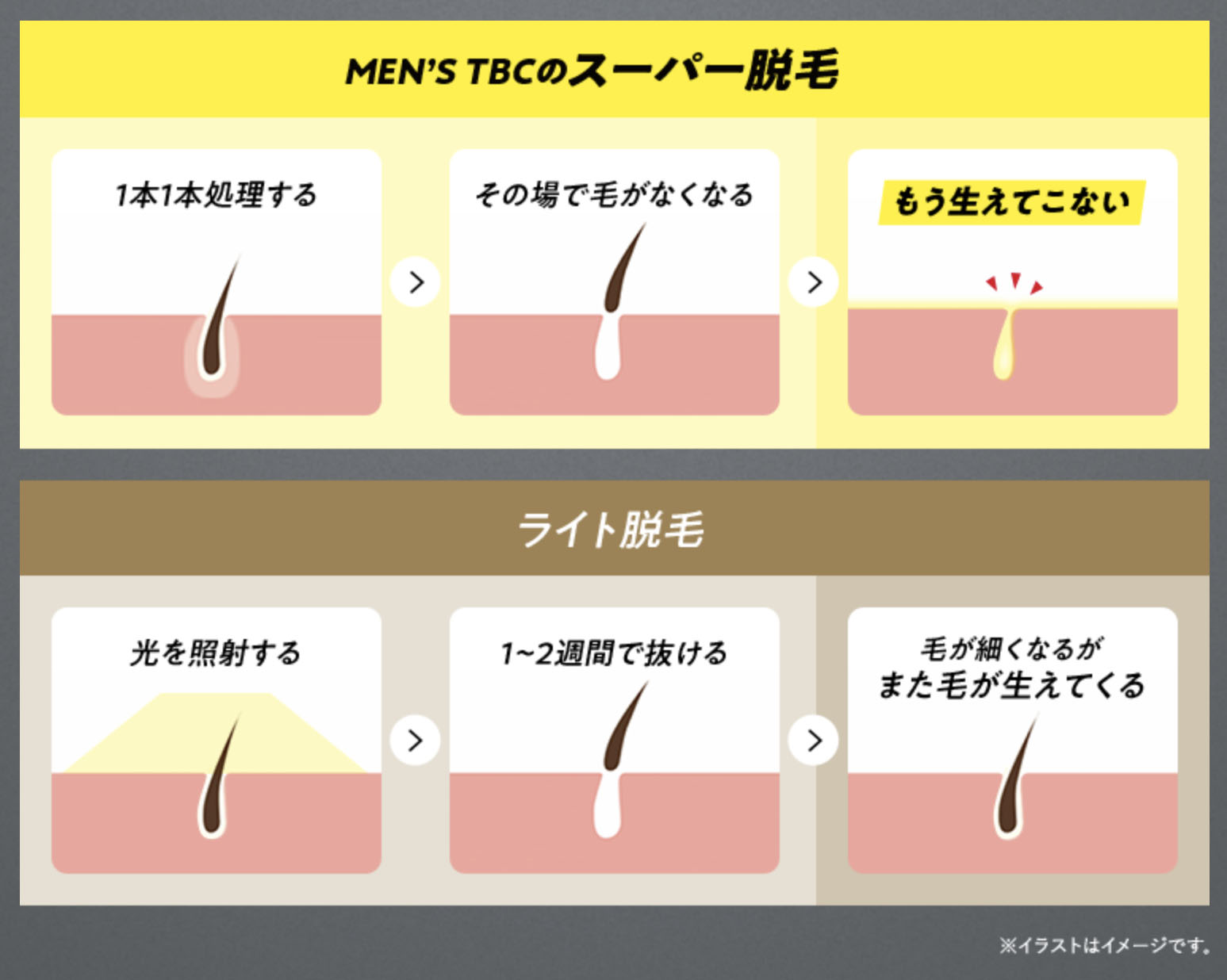 メンズTBCの髭・VIO・全身脱毛の効果を徹底分析！ | メンズ脱毛の比較・分析・診断サイト | リコメン